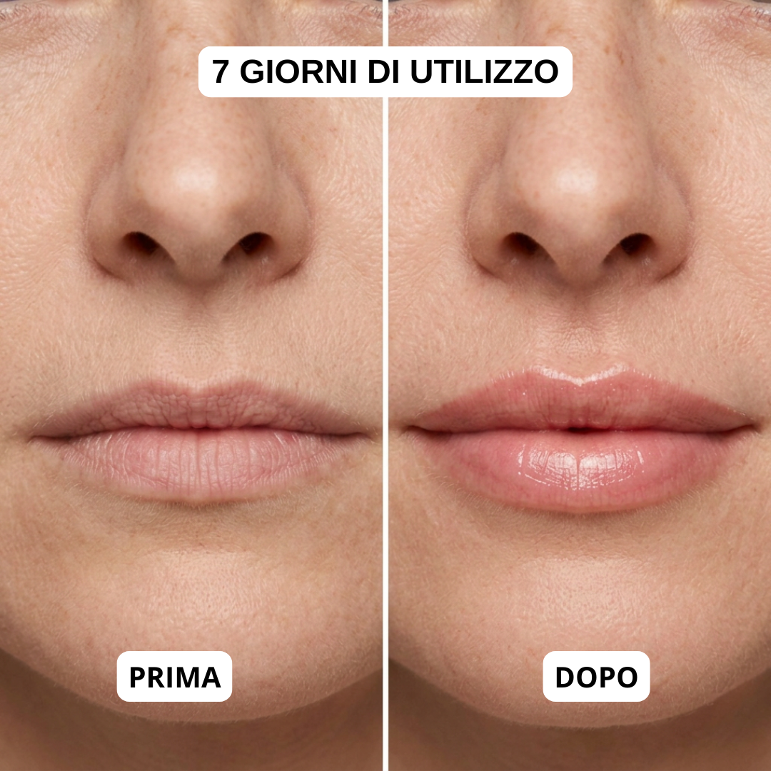 Salutly Kit Effetto Filler