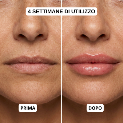 Salutly Kit Effetto Filler
