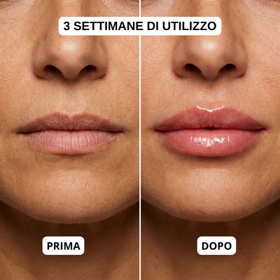 Salutly Kit Effetto Filler